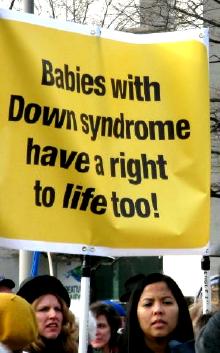Banner proclaims: 'Babies with Down syndrome have a right to life too!'